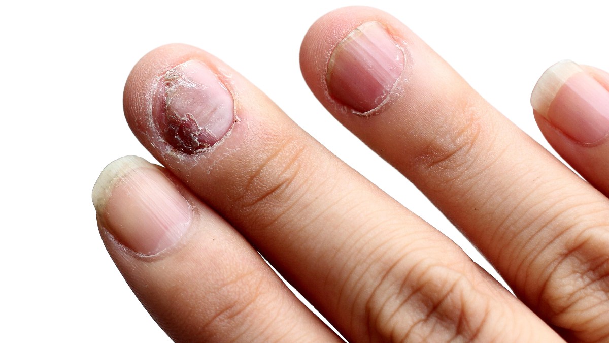 Cuidado Clínico y Estético: Las Afectaciones más Comunes en Manos, Pies y Uñas que Resuelven la Manicura y Pedicura